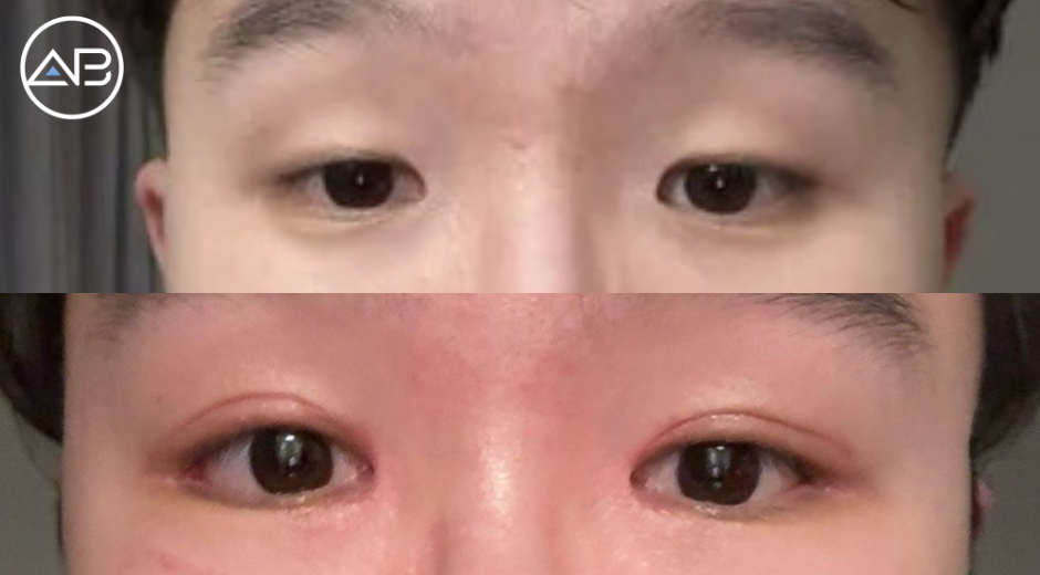 AB Plastic Surgery