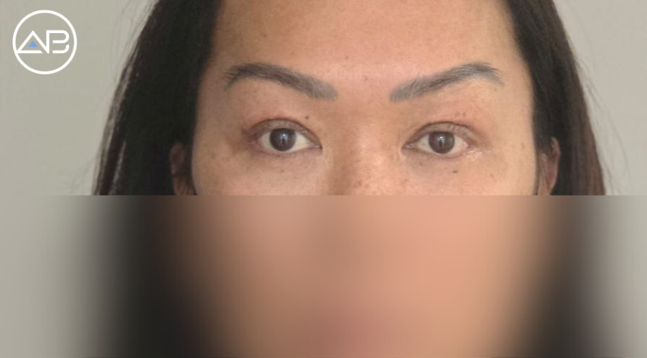 AB Plastic Surgery