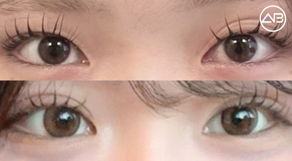 AB Plastic Surgery