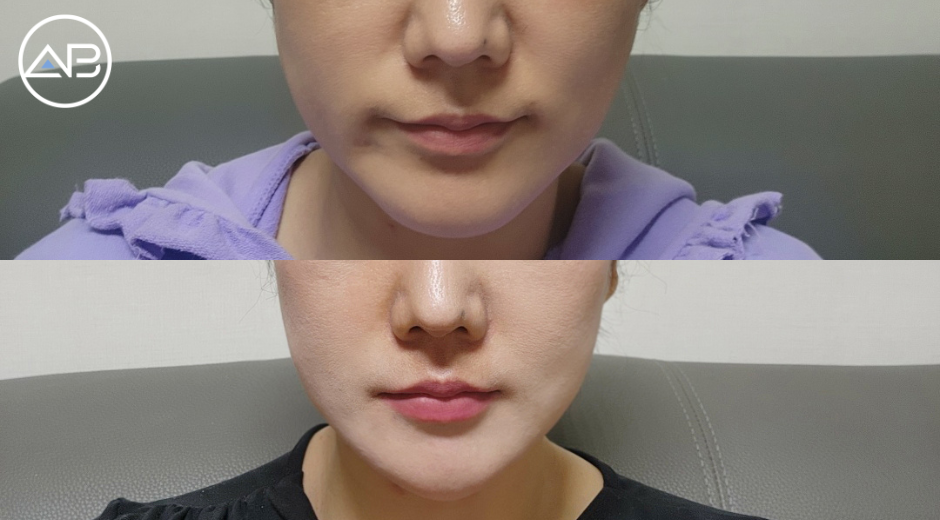 AB Plastic Surgery
