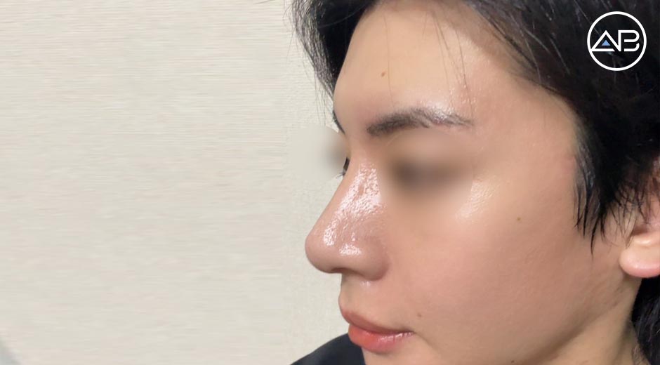 AB Plastic Surgery