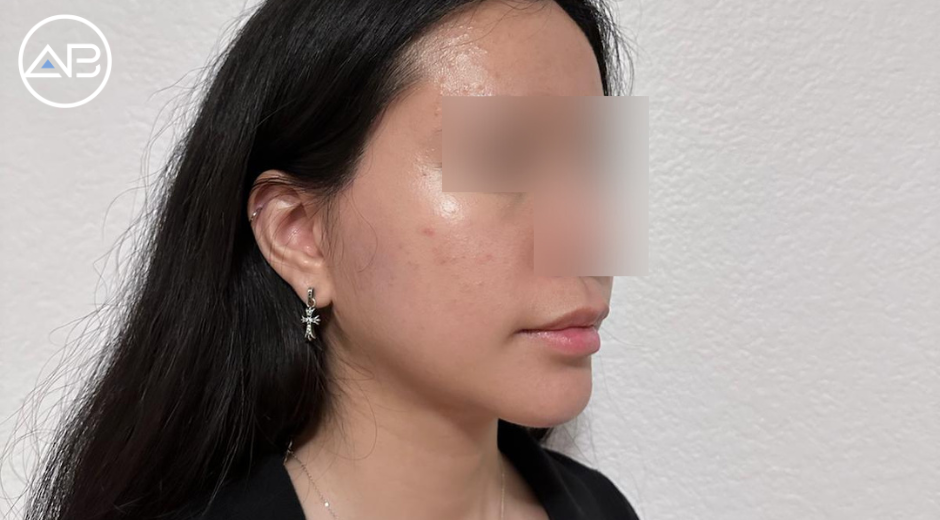 AB Plastic Surgery