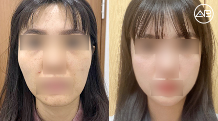 AB Plastic Surgery