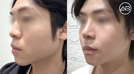 AB Plastic Surgery
