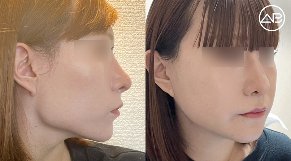 AB Plastic Surgery