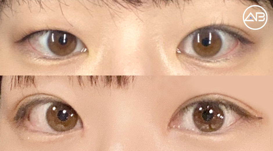 AB Plastic Surgery