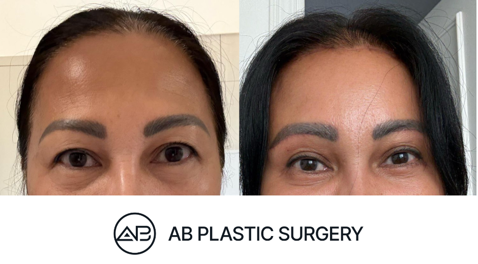 AB Plastic Surgery